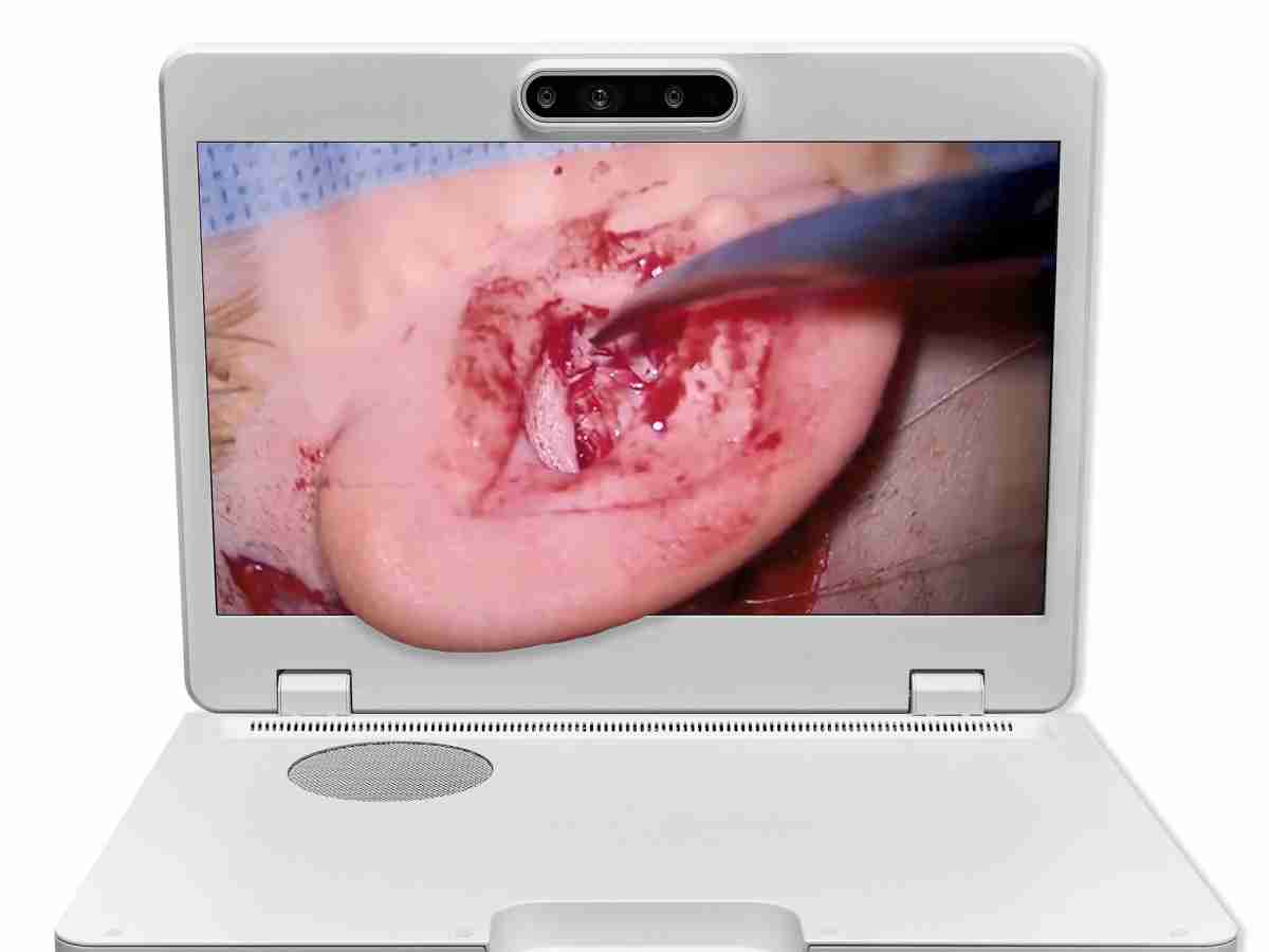 达擎之＂Heads-up 3D显微手术显示系统＂，，整合4K裸眼3D显示及眼球追踪系统，，具备快速追踪人眼移动位置功能，，，，减轻医师长时间维持固定姿势的负担，，，让医师能有更宽广清晰的3D立体视野及更舒适的姿势来执行手术。。。